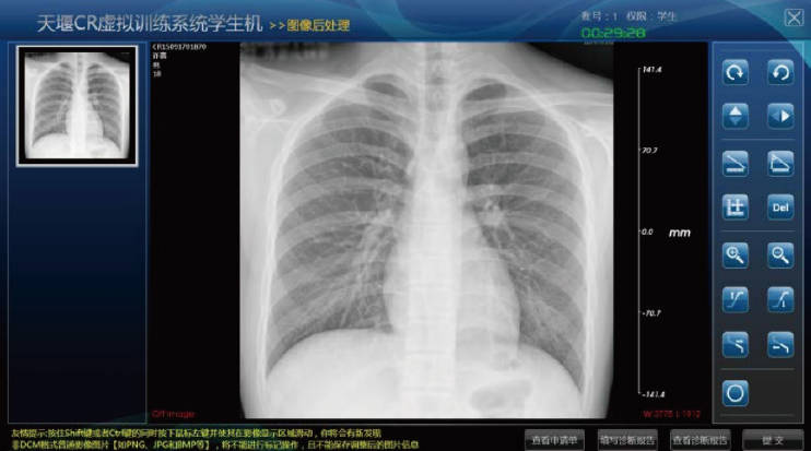 虛擬CR訓練系統